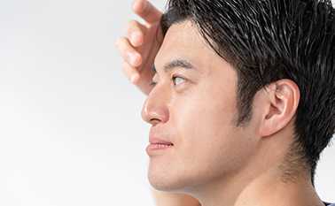 AGA（男性型脱毛症）の治療に対応