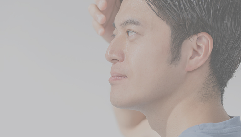 自費診療（AGA）