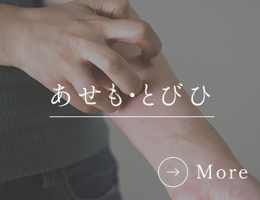 あせも、とびひ